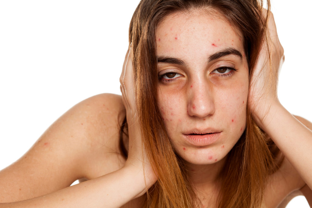 How Drugs Ruin Your Skin